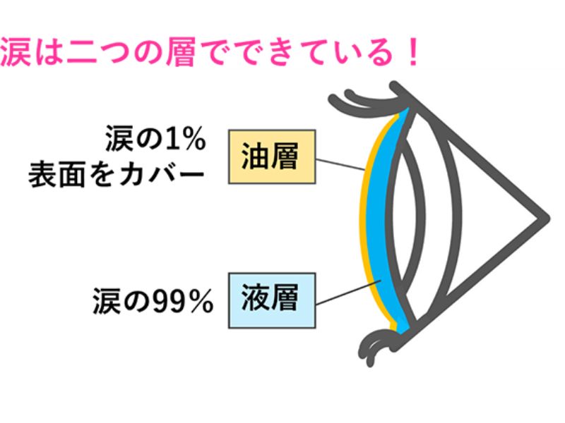 CS眼科-ドライアイ