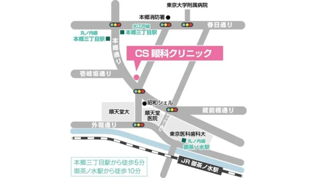 CS眼科クリニック 内斜視治療