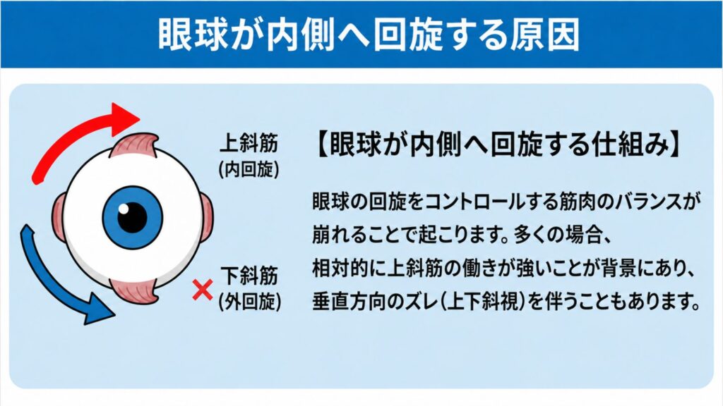 眼球が内側へ回線する原因の図解