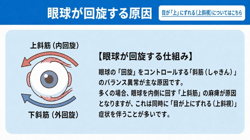 CS眼科クリニック_外方回旋斜視治療